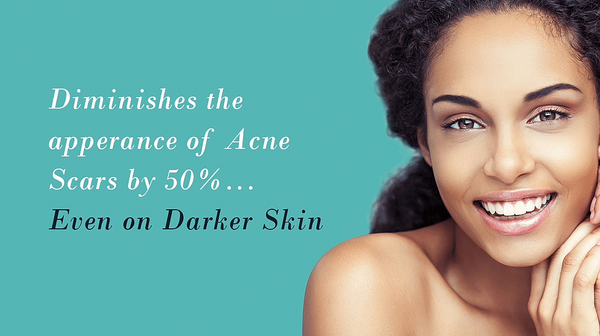 Houston Morpheus8 model with curly hair