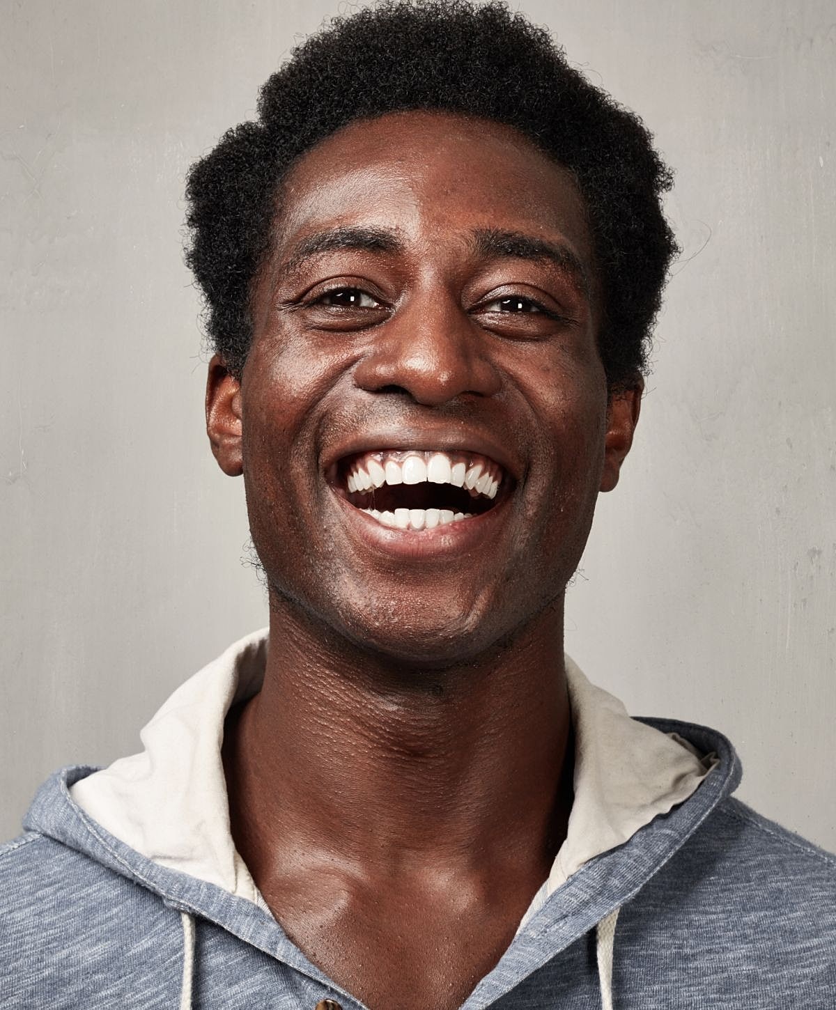 Houston Botox For Men model smiling