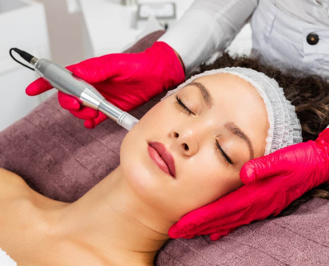 Beautiful woman receiving microneedling rejuvenation treatment. Mesotherapy.