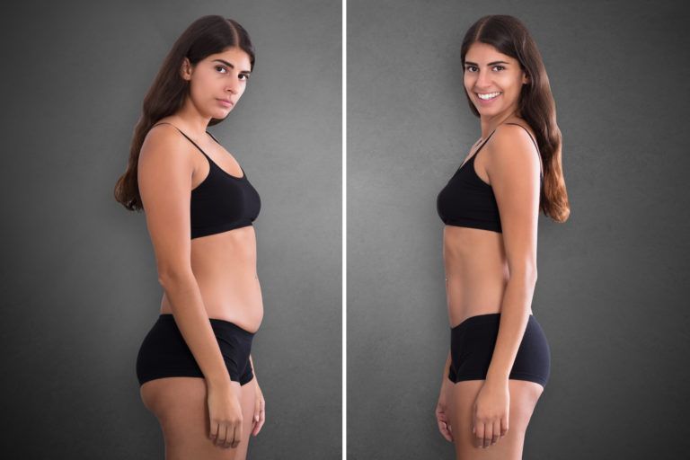 Why Choose Vaser Liposuction